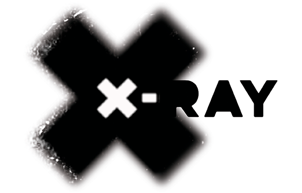 X-RAY